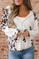 Oversized Leopard Patchwork Zip Up Hoodie